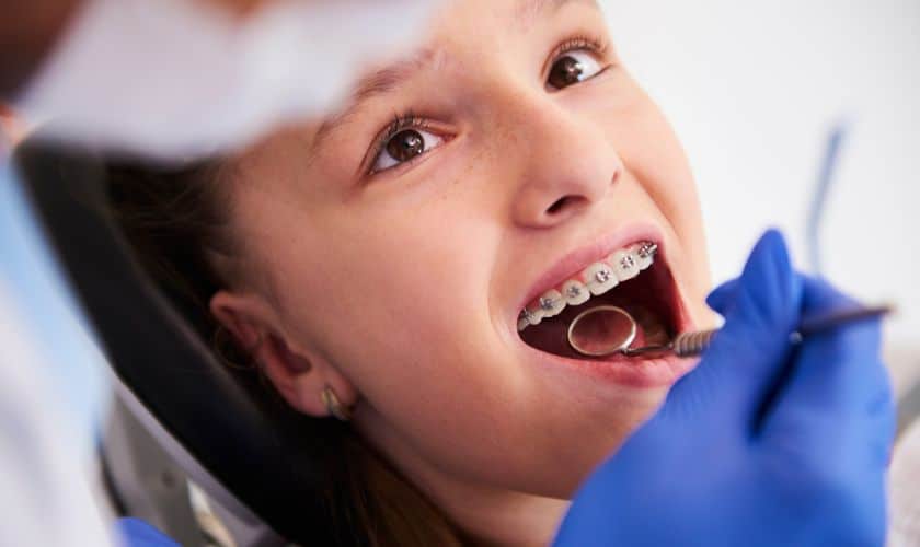How to Care for Your Teeth While Wearing Braces - Woolaver Orthodontics