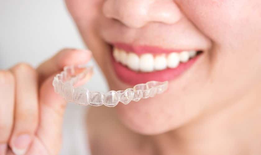 What is Invisalign Express and how does it differ from regular Invisalign treatment - Woolaver Orthodontics