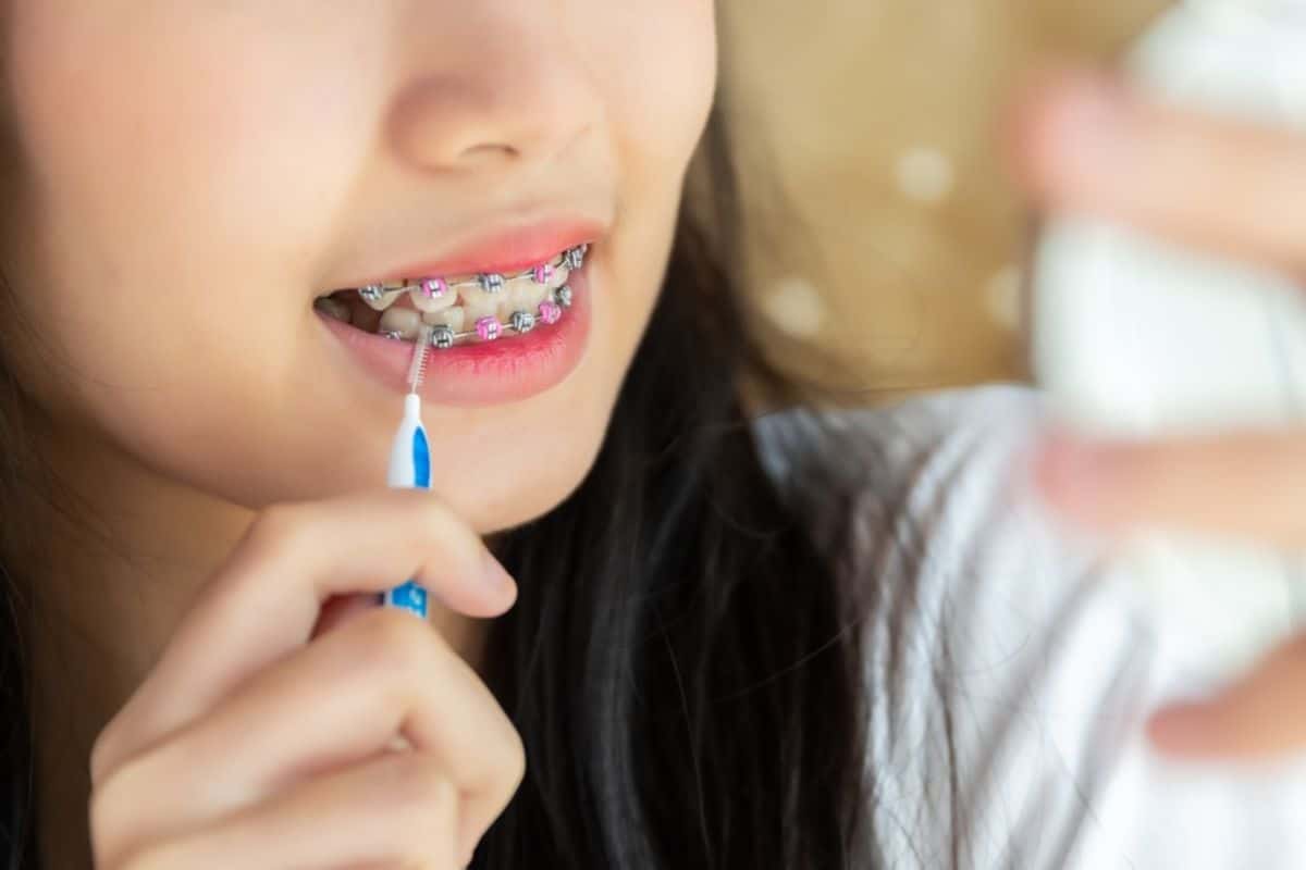 lady cleaning teeth with interdental brush after a meal