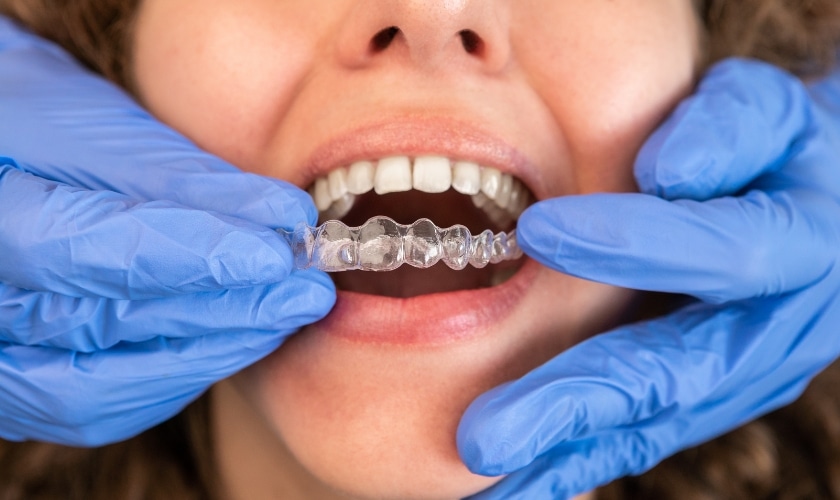 Featured image for “Invisalign: The Clear Path to a Confident Smile”