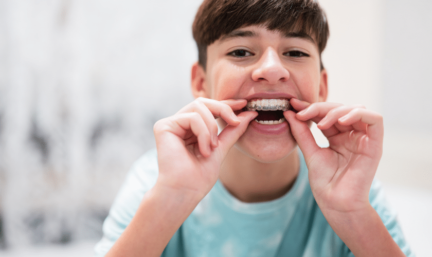 Featured image for “Teen Invisalign Success Stories: Transforming Smiles and Confidence”