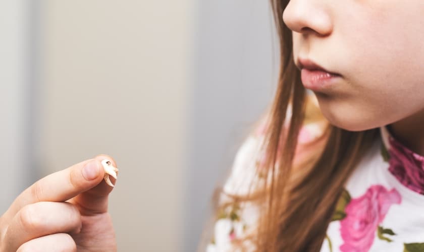 Tooth Decay and Cavities