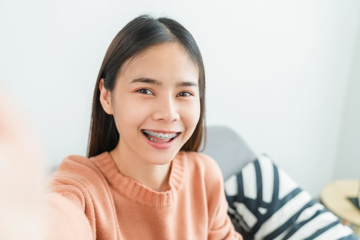 braces smile