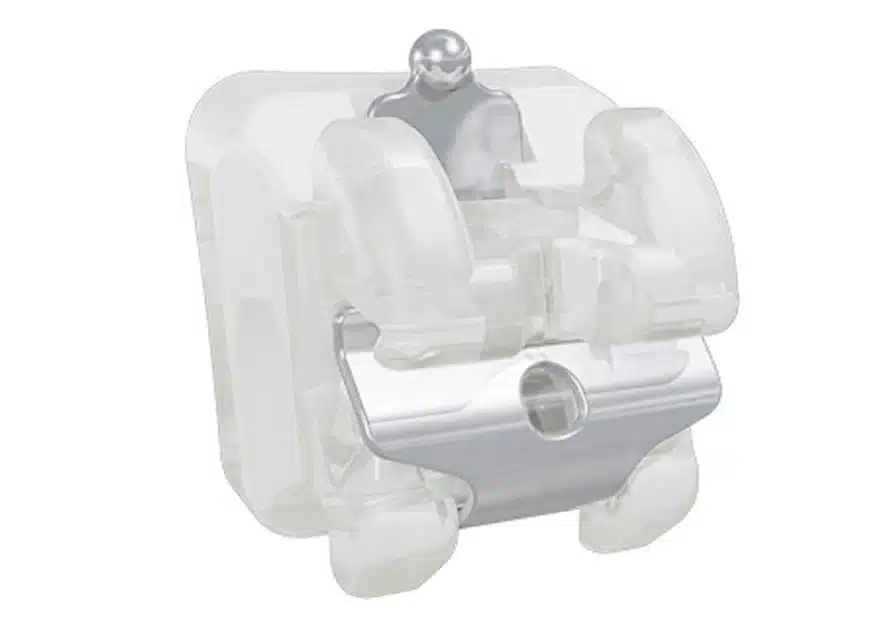 self ligating braces