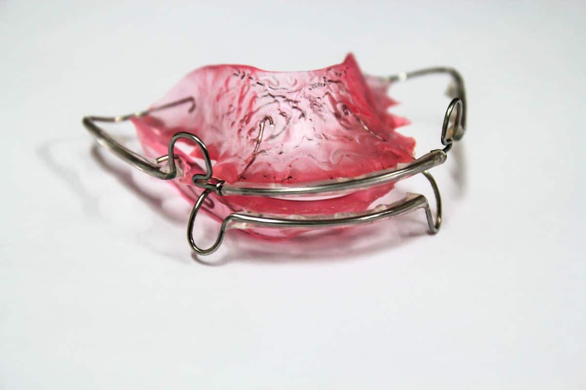 orthodontic retainer after wisdom teeth removal