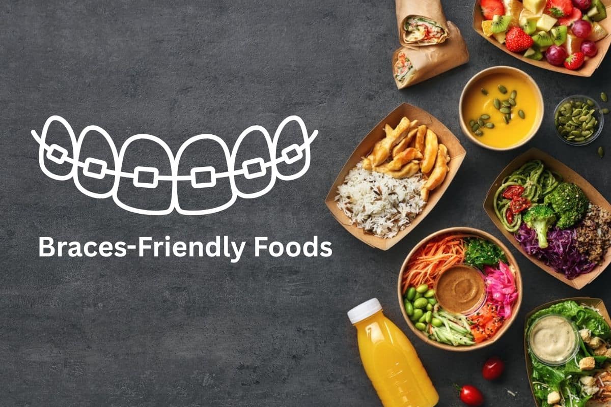 Featured image for “Soft Foods to Eat with Braces – A Helpful Guide from Your Dental Team”