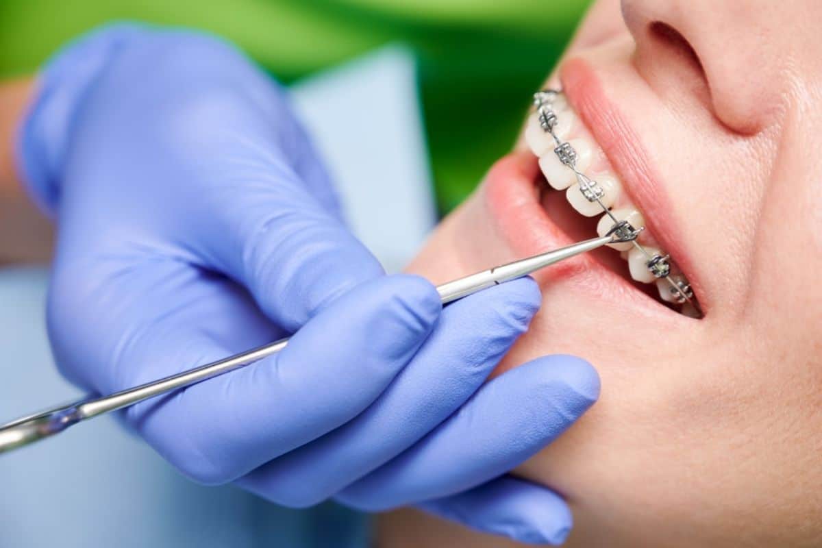 sore teeth from braces adjustment